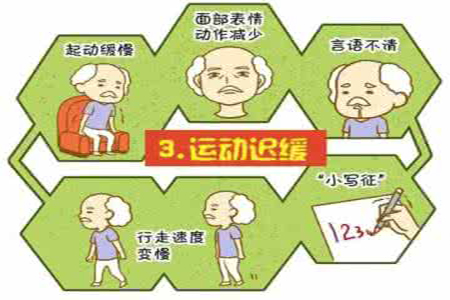 帕金森病-行动迟缓