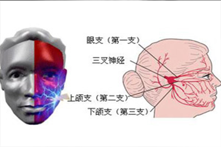 三叉神经在什么位置