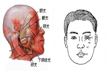面部肌肉痉挛，要警惕面肌痉挛